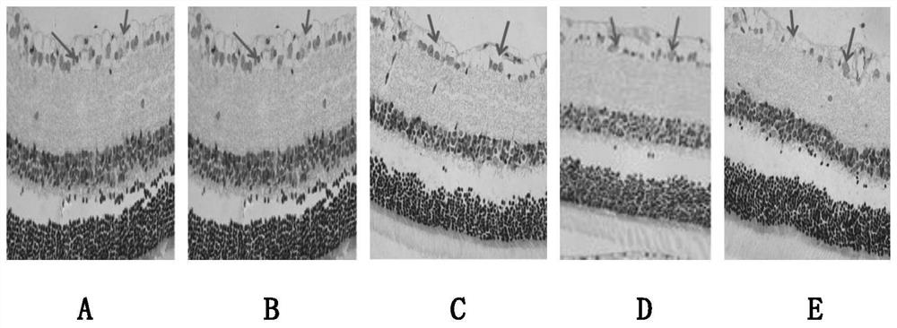 Medicine for treating glaucoma and preparation method of medicine