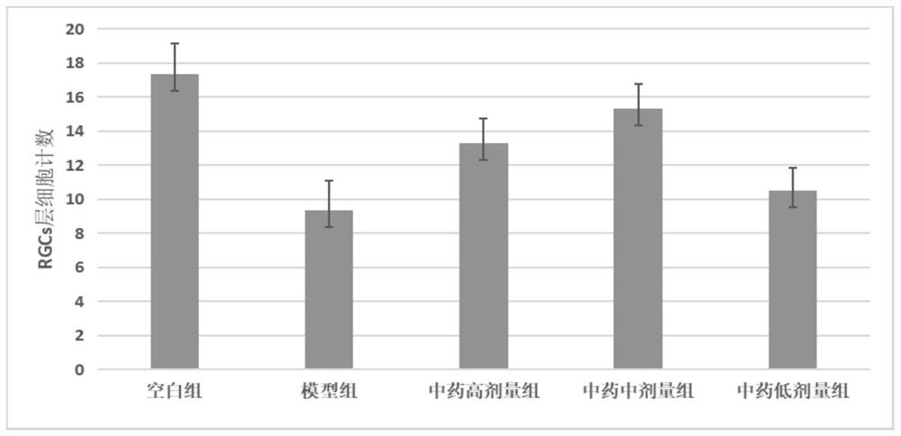 Medicine for treating glaucoma and preparation method of medicine