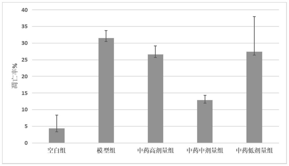 Medicine for treating glaucoma and preparation method of medicine