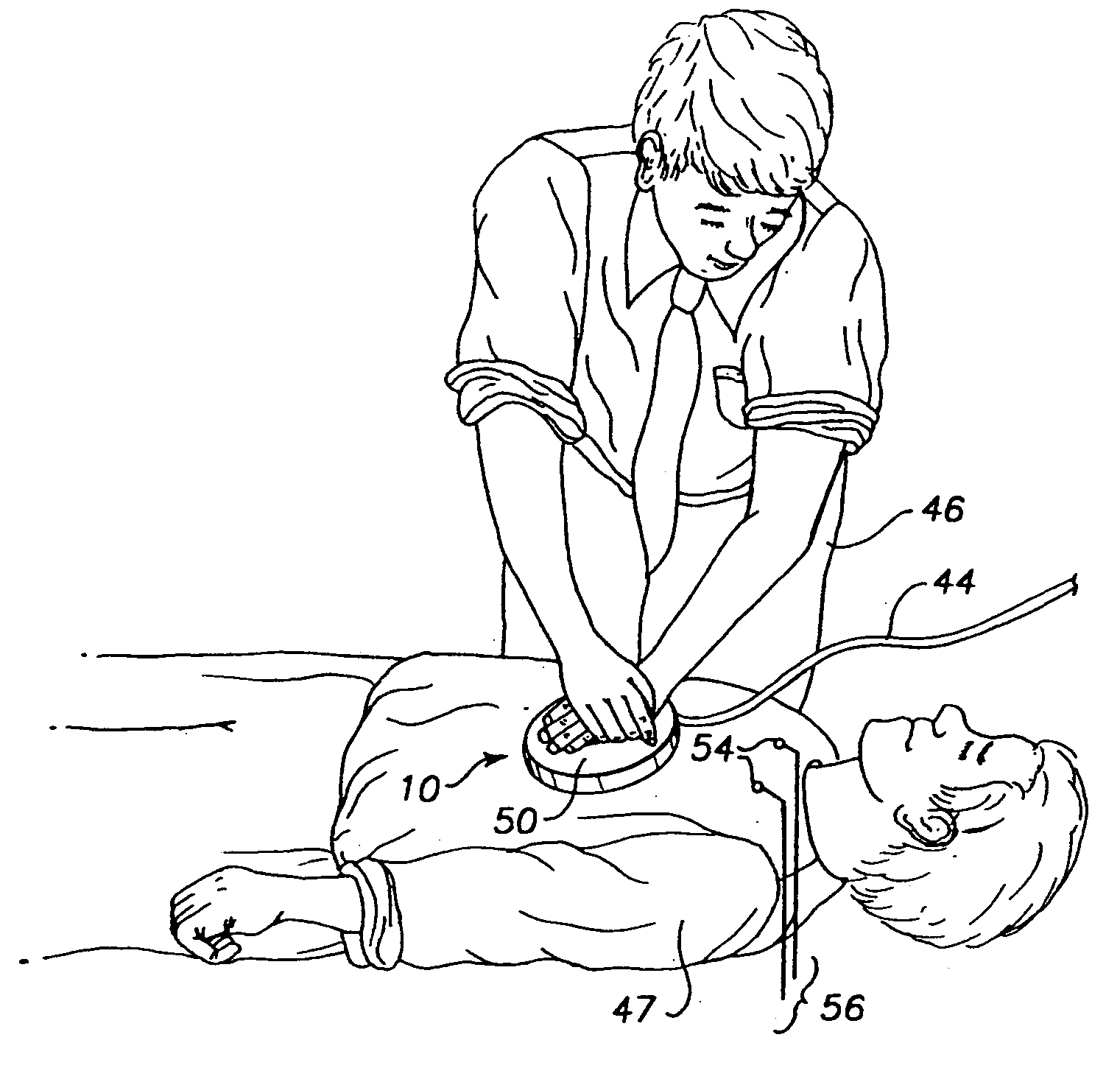 ECG signal processor and method