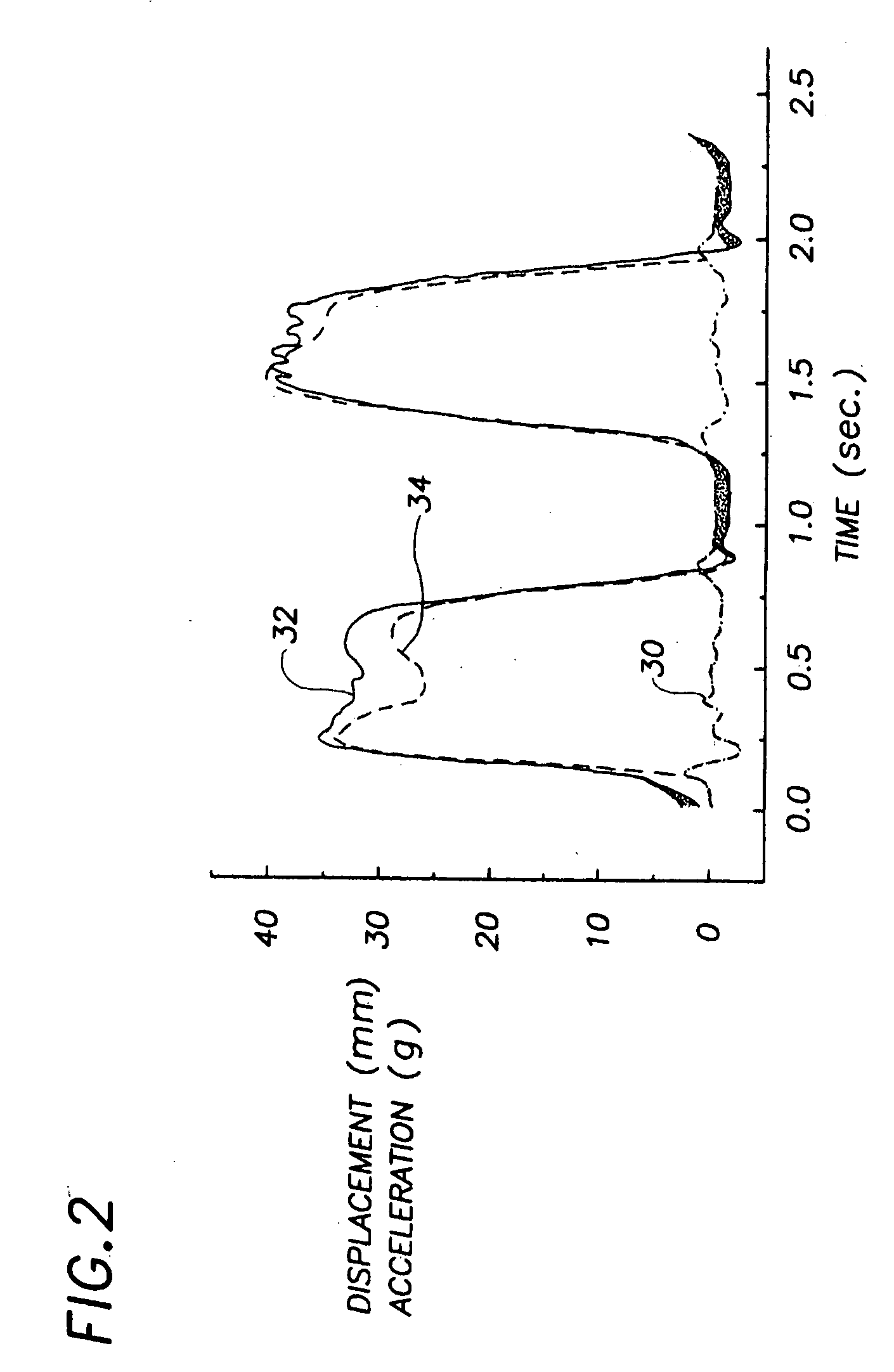 ECG signal processor and method