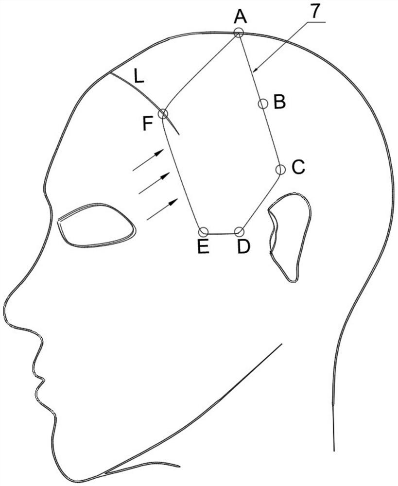 Head and face three-dimensional lifting method