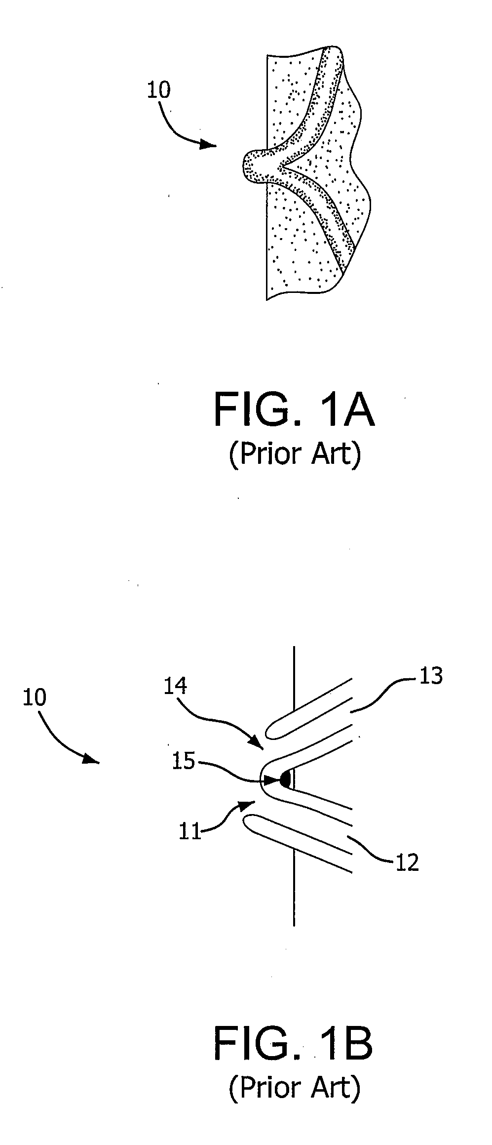 Medical Device for use with a Stoma