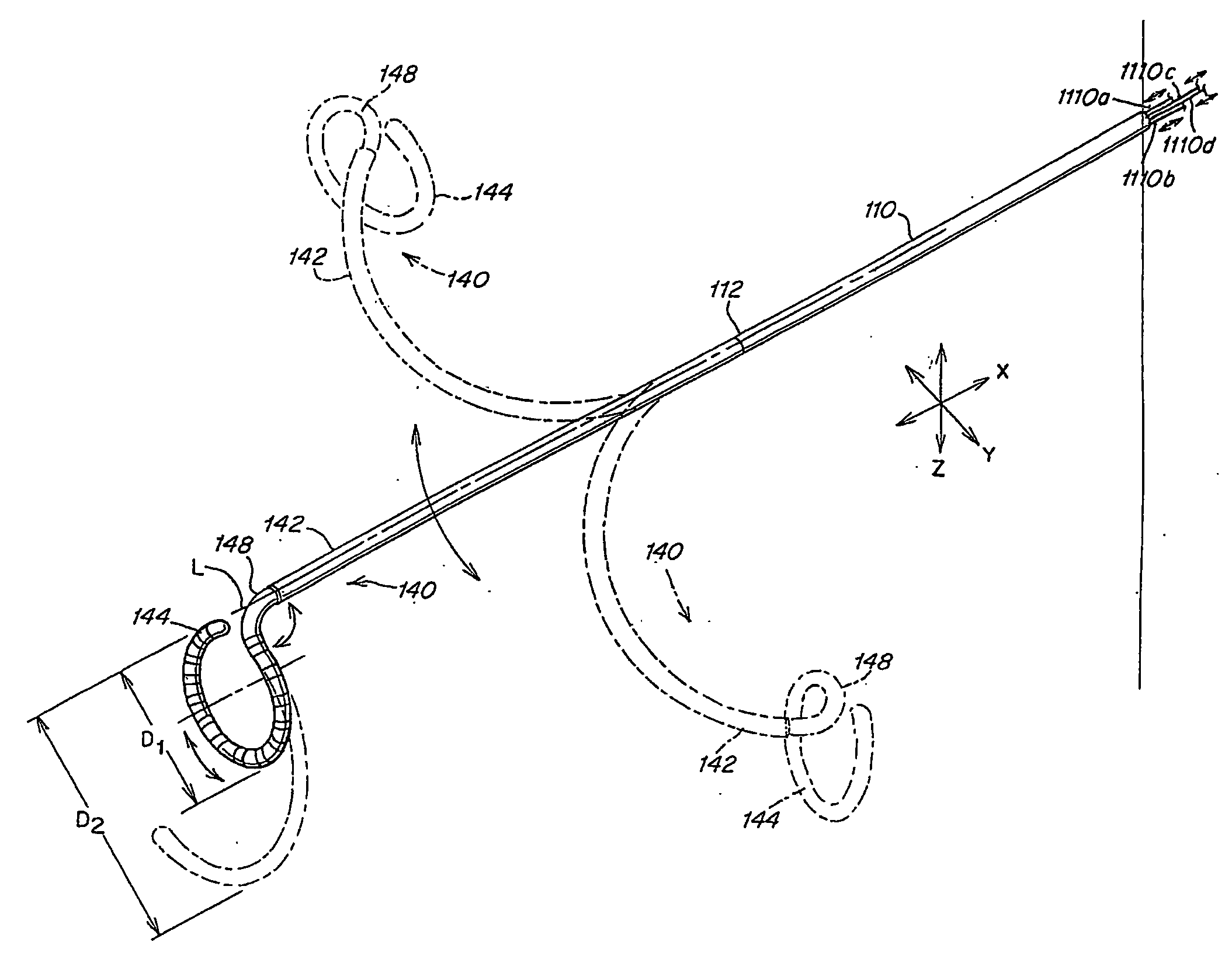 Electrophysiology loop catheter