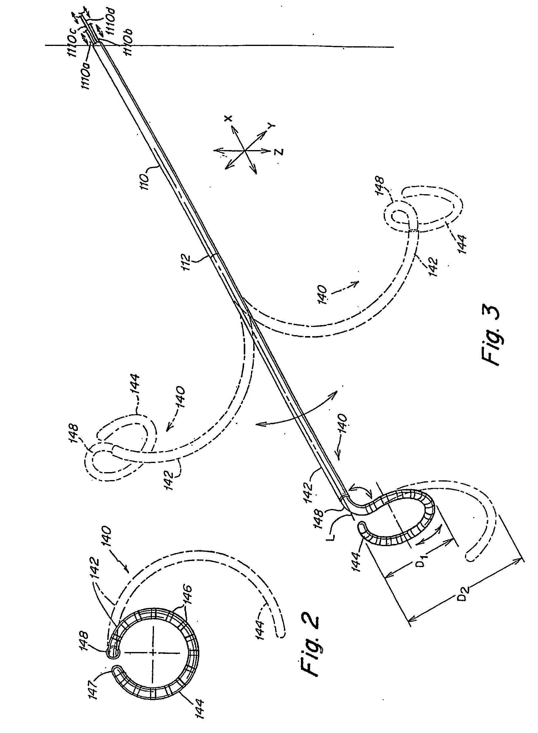 Electrophysiology loop catheter