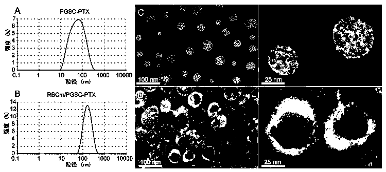 Preparation method and application of erythrocyte membrane-coated acid-sensitive polymer prodrug nano drug delivery system