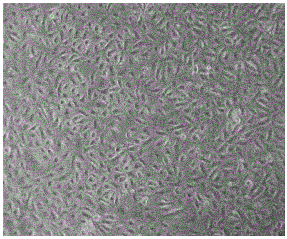 Human bronchial epithelial cell strain HBE-TT