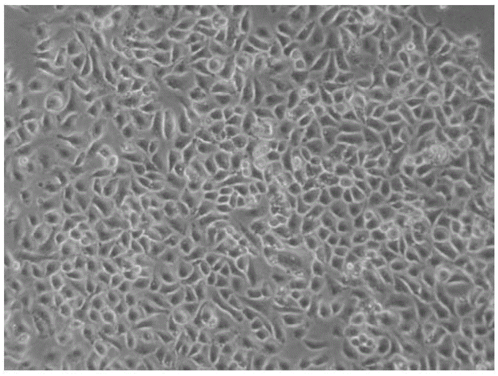 Human bronchial epithelial cell strain HBE-TT