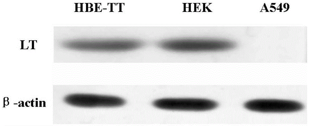 Human bronchial epithelial cell strain HBE-TT