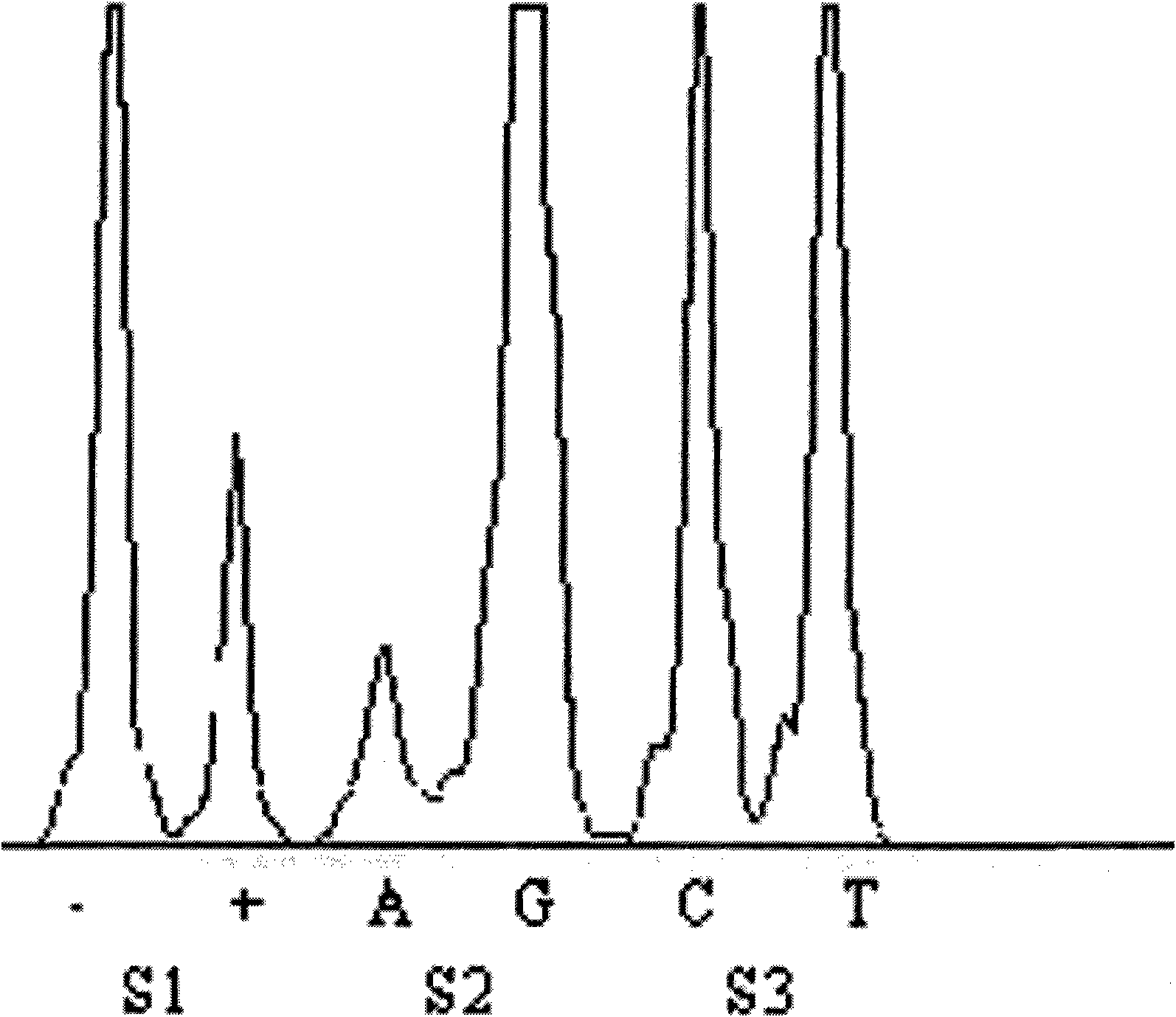 Mi RNA marker related to side effect of platinum-based chemotherapy to advanced NSCLC patient and application thereof