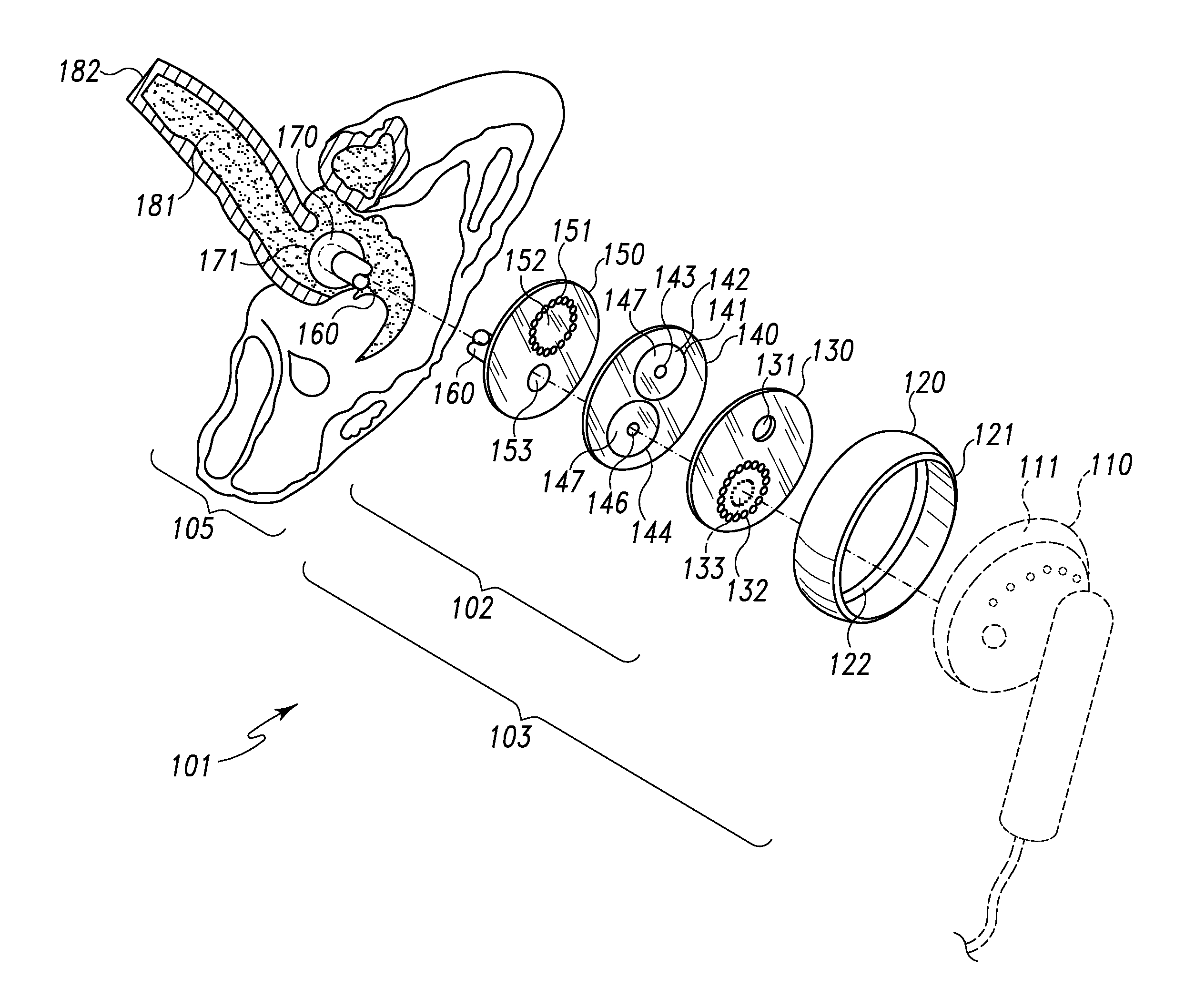 Diaphonic acoustic transduction coupler and ear bud