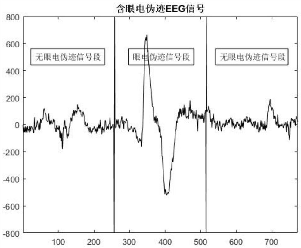 A Method for Removing Artifact Signals in EEG Signals