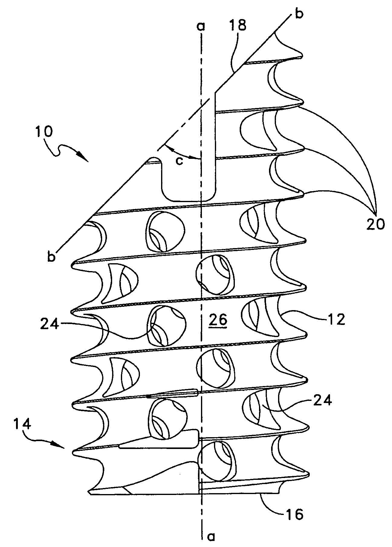 Fixation screw, graft ligament anchor assembly, and method for securing a graft ligament in a bone tunnel