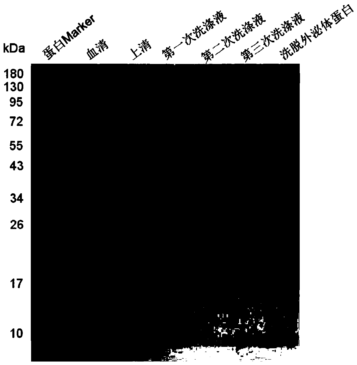 Method for separating exosomes from plasma on basis of immobilized metal affinity chromatography