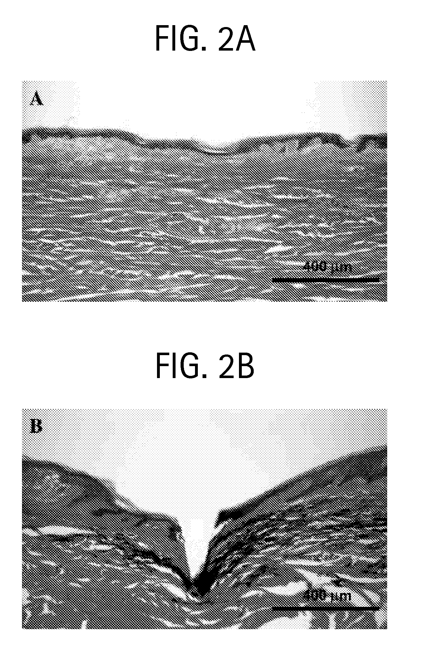 Microneedles and Methods for Microinfusion