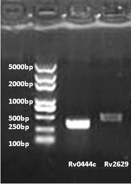 Method for detecting Beijing genotype of tuberculosis mycobacteria