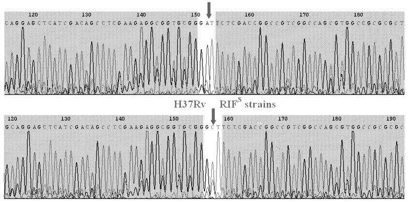 Method for detecting Beijing genotype of tuberculosis mycobacteria