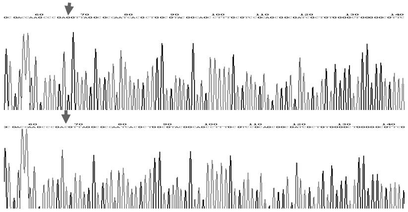 Method for detecting Beijing genotype of tuberculosis mycobacteria