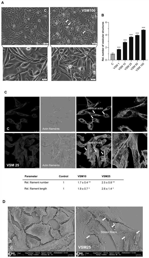 Application of VSM in preparation of medicine for treating rhabdomyosarcoma