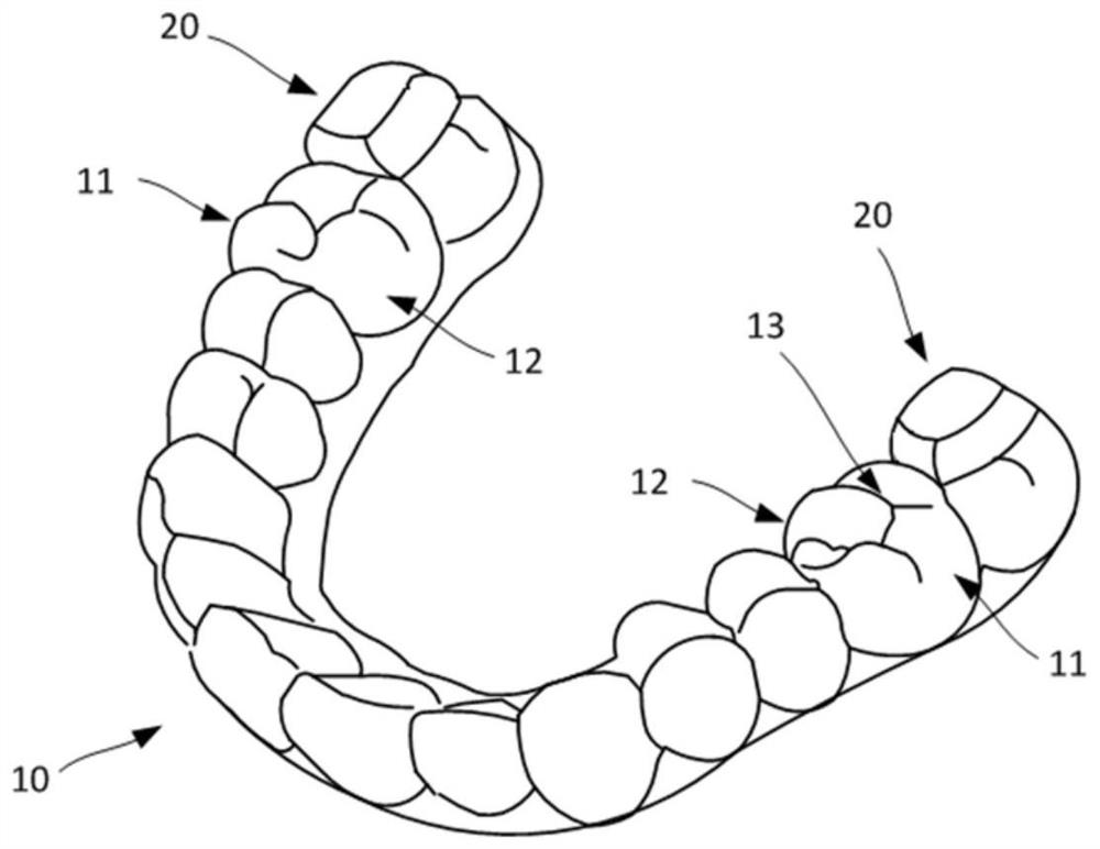 Posterior decompression occlusal plate and manufacturing method thereof