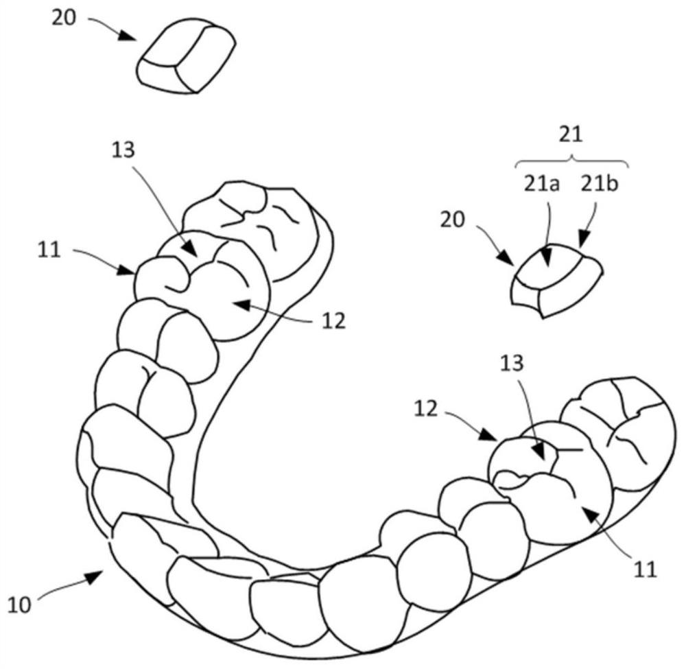 Posterior decompression occlusal plate and manufacturing method thereof