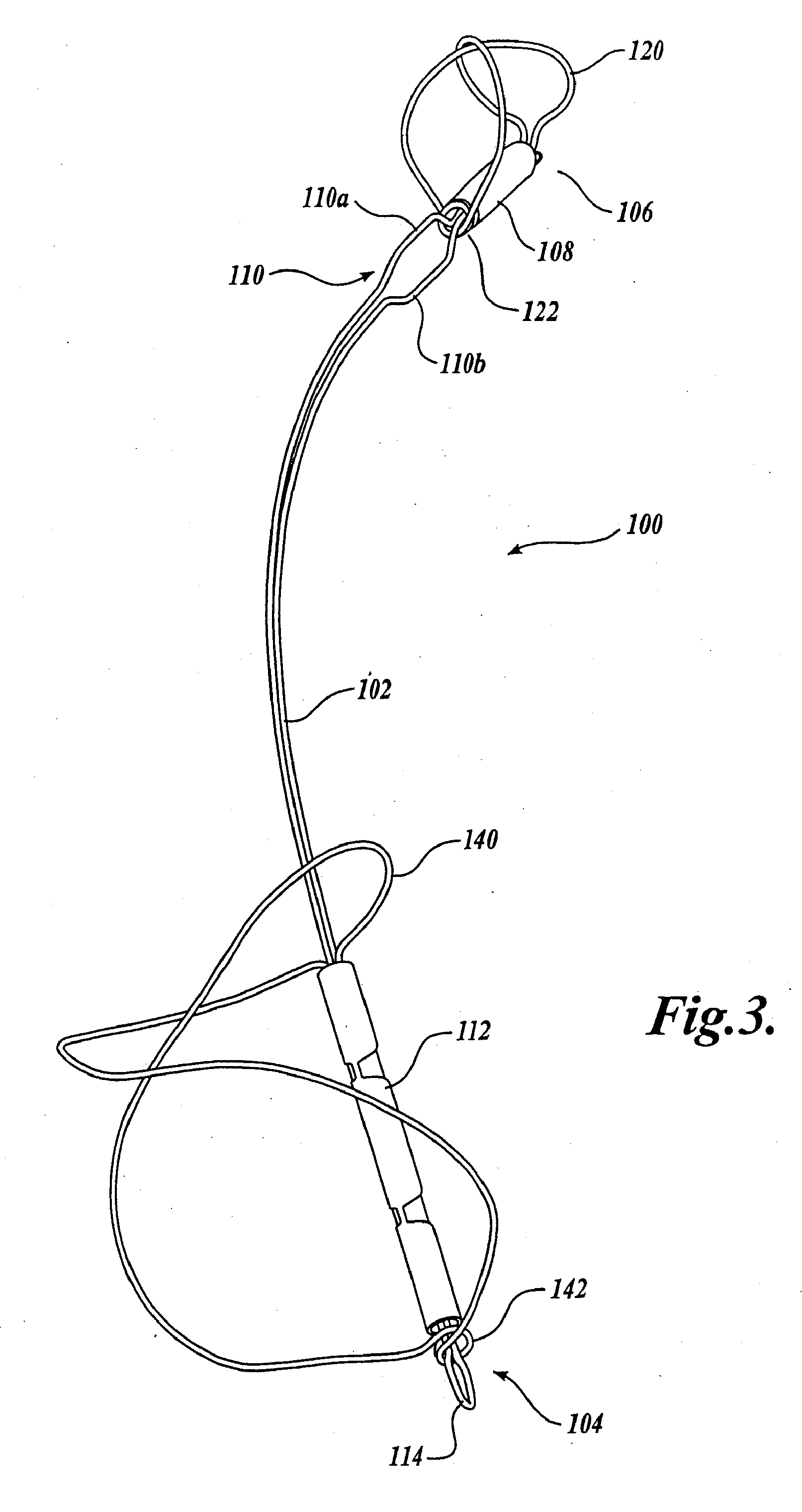 Device and method for modifying the shape of a body organ