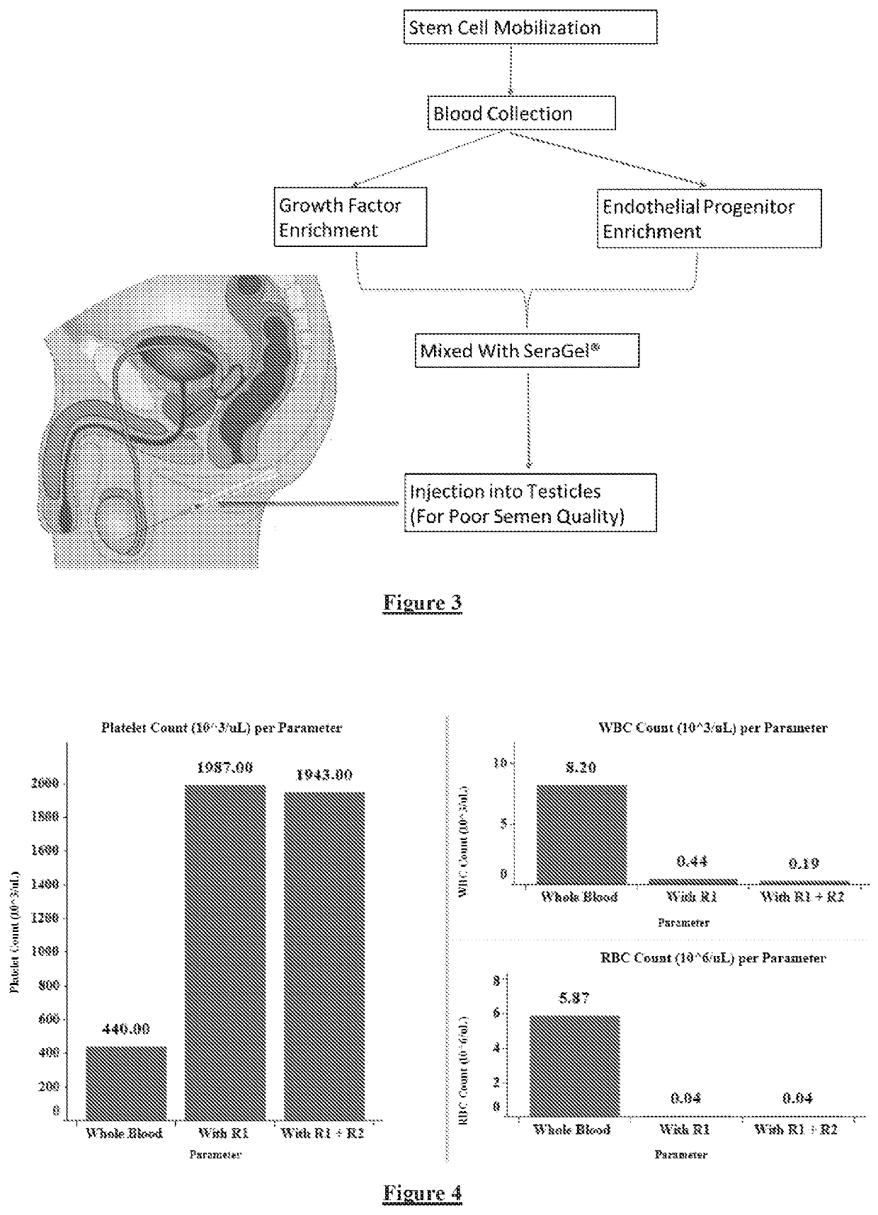 Compositions for treatment of azoospermia, methods for preparing the same and applications thereof