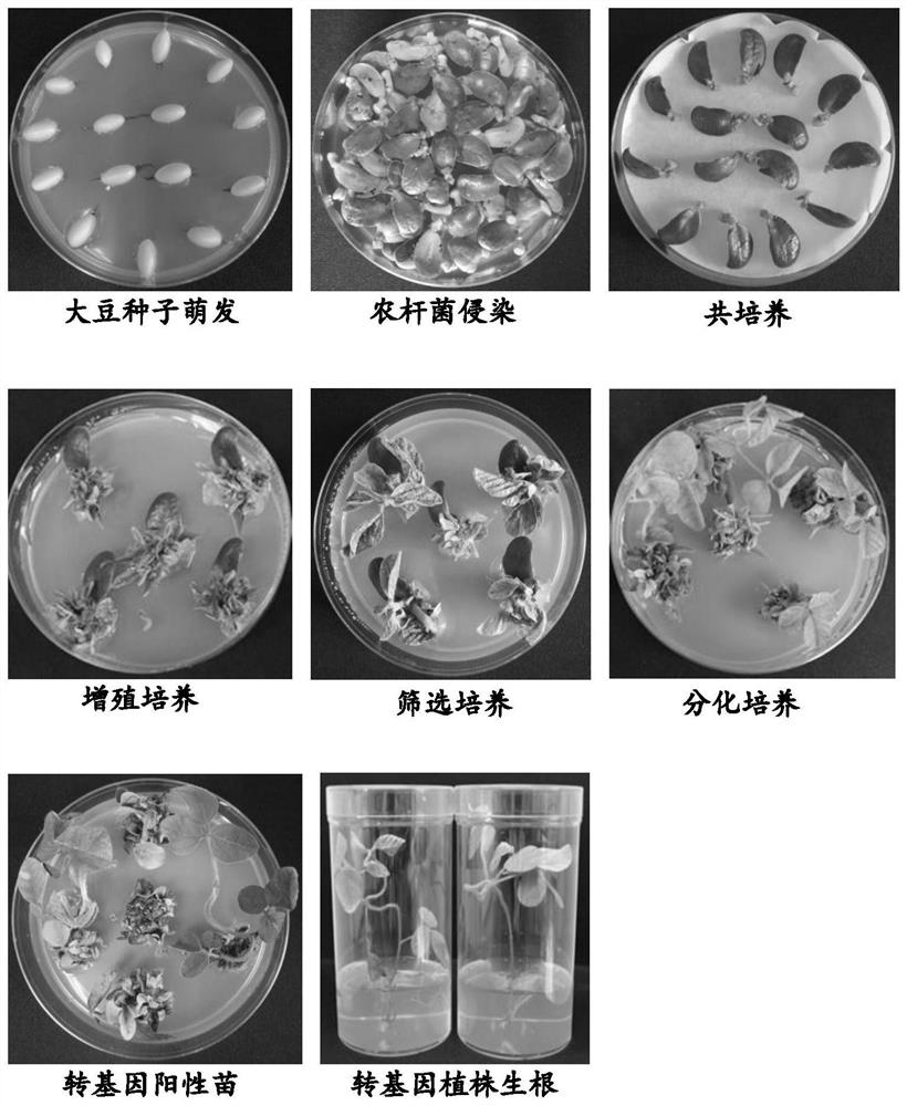 Methods for Improving Transformation Efficiency of Soybean