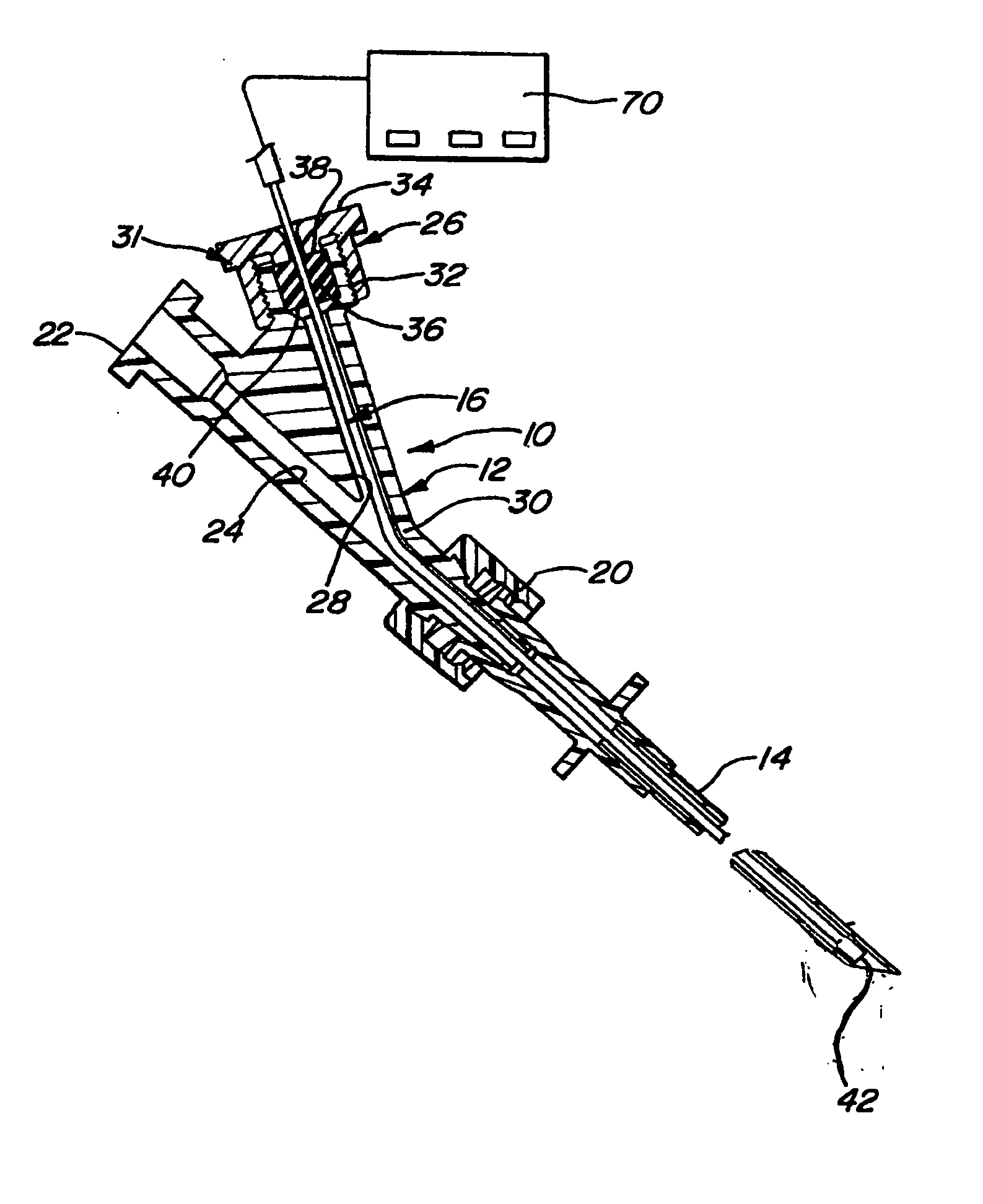 Regional anesthetic method and apparatus