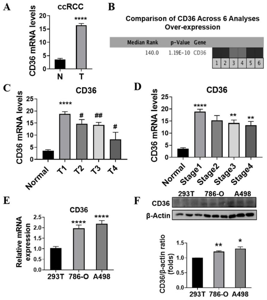 Application of fatty acid transporter CD36 and inhibitor thereof in treatment and diagnosis of renal clear cell carcinoma