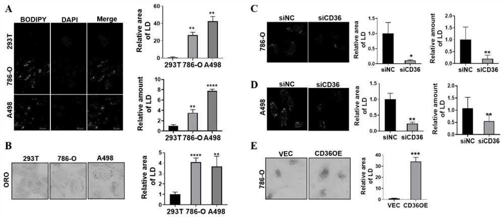 Application of fatty acid transporter CD36 and inhibitor thereof in treatment and diagnosis of renal clear cell carcinoma