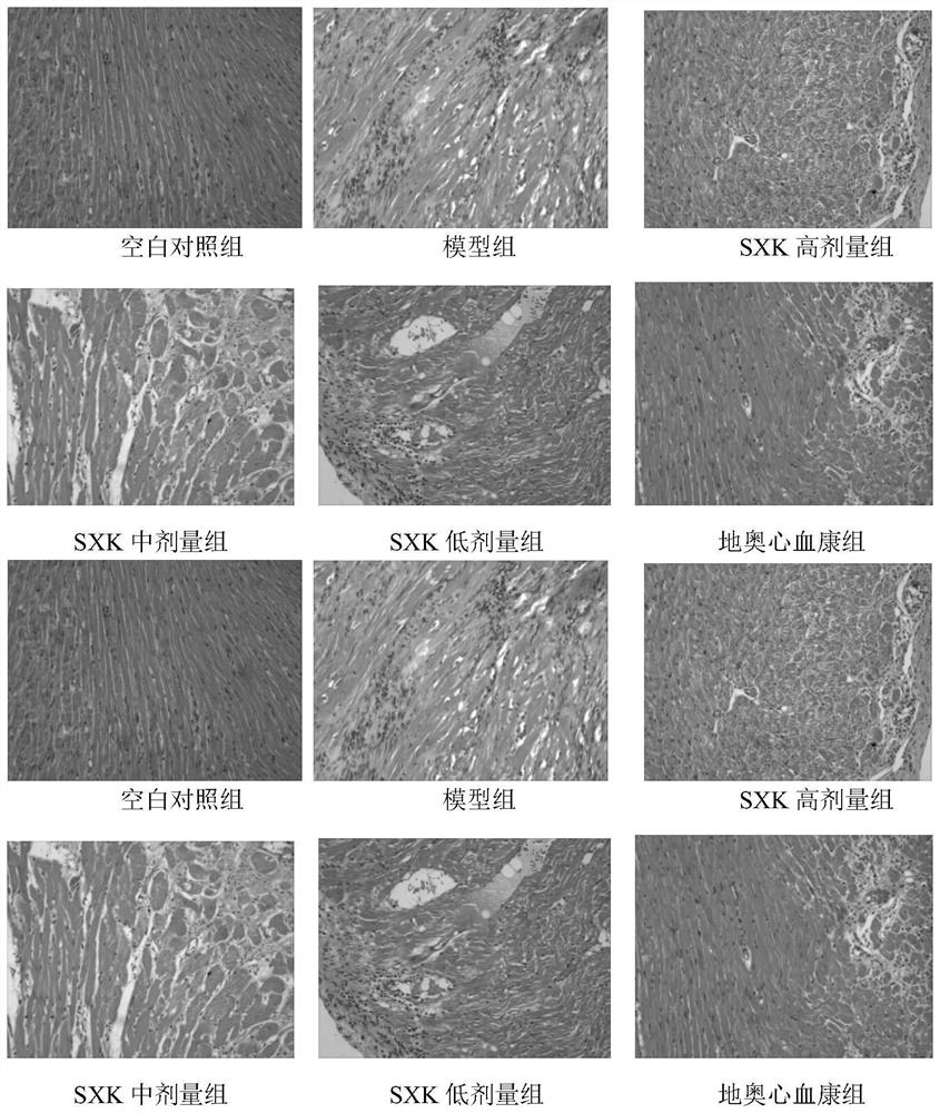 Preparation method of traditional Chinese medicine composition for resisting myocardial ischemia