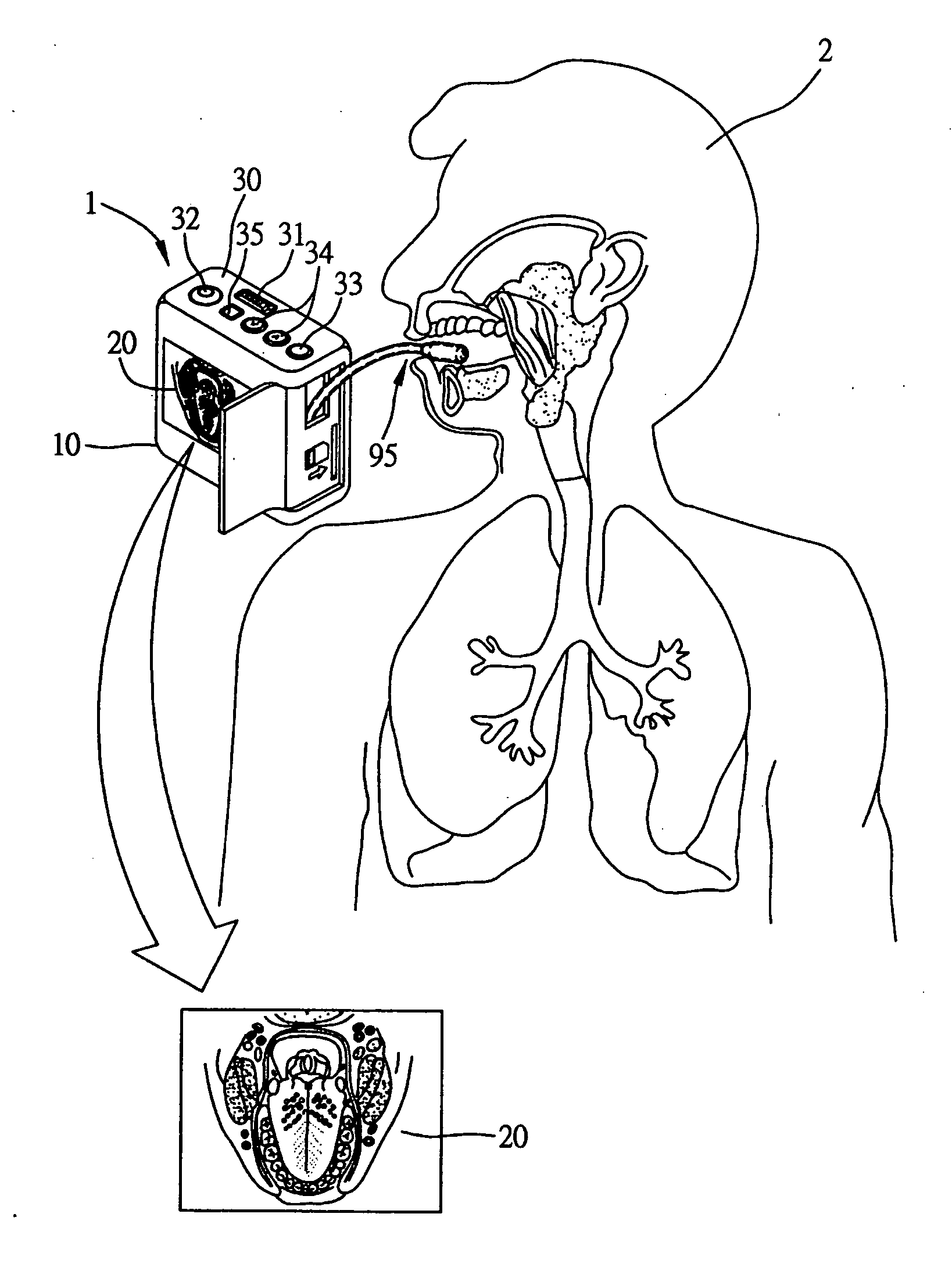Endoscope apparatus