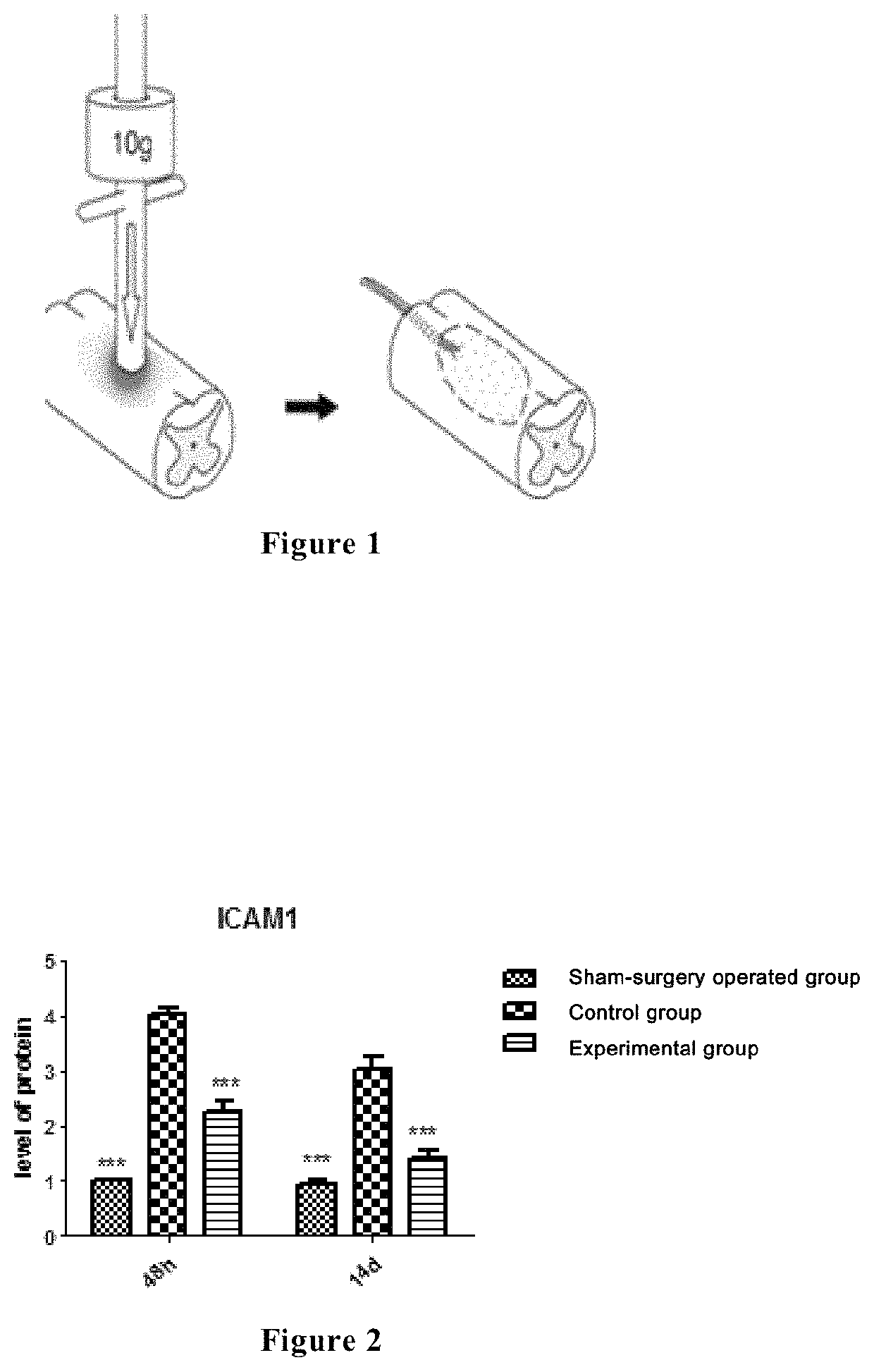 Use of a compound in repairing nerve injury