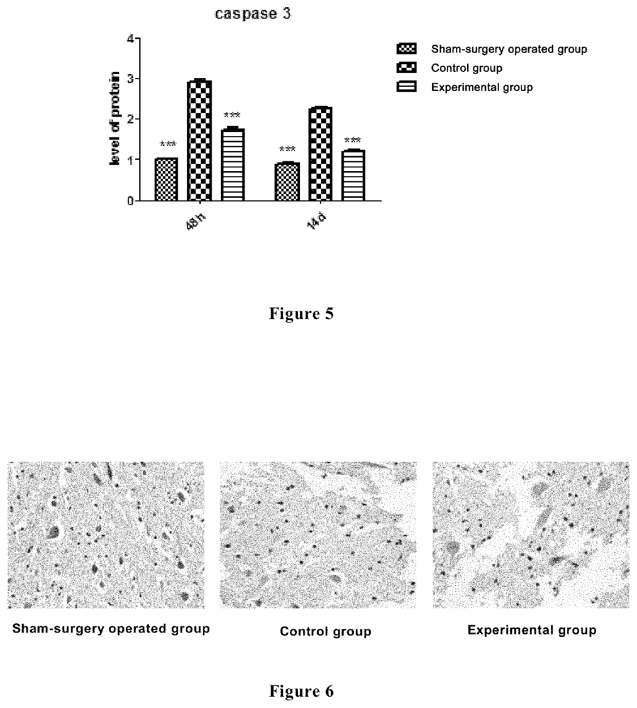 Use of a compound in repairing nerve injury