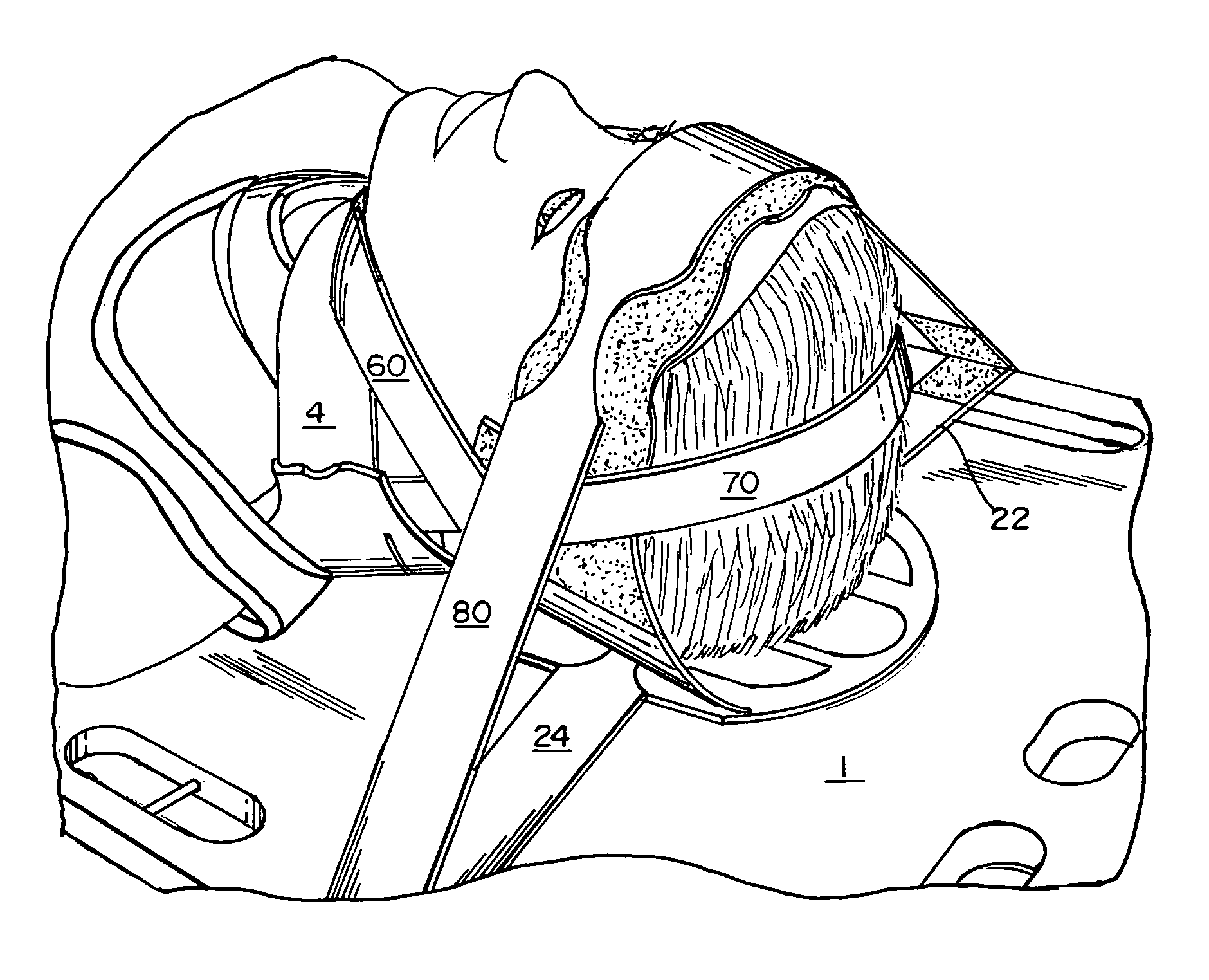 Method and device for stabilizing a patient's head on a spine board