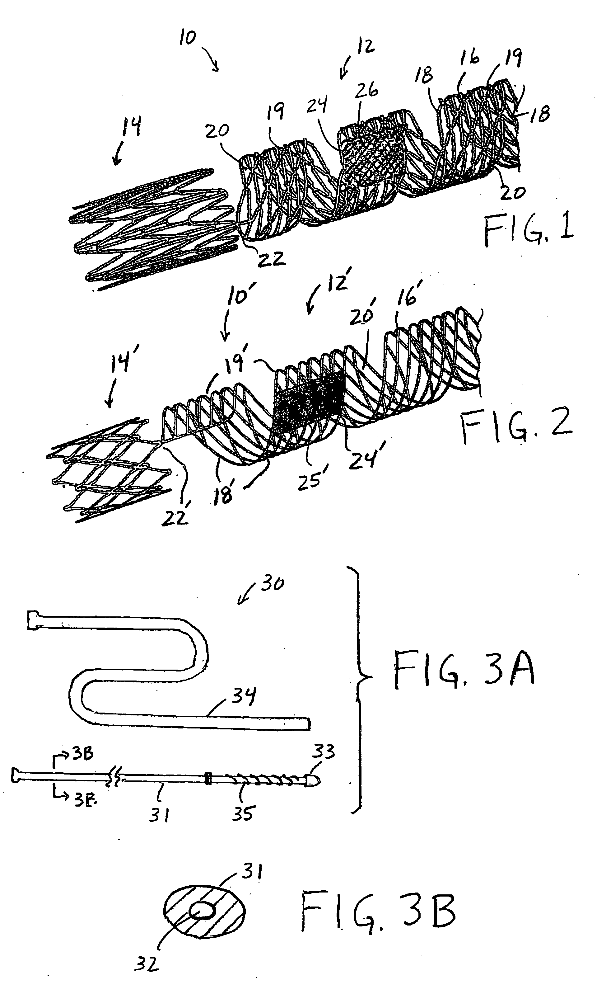 Prosthesis, delivery system and method for neurovascular aneurysm repair