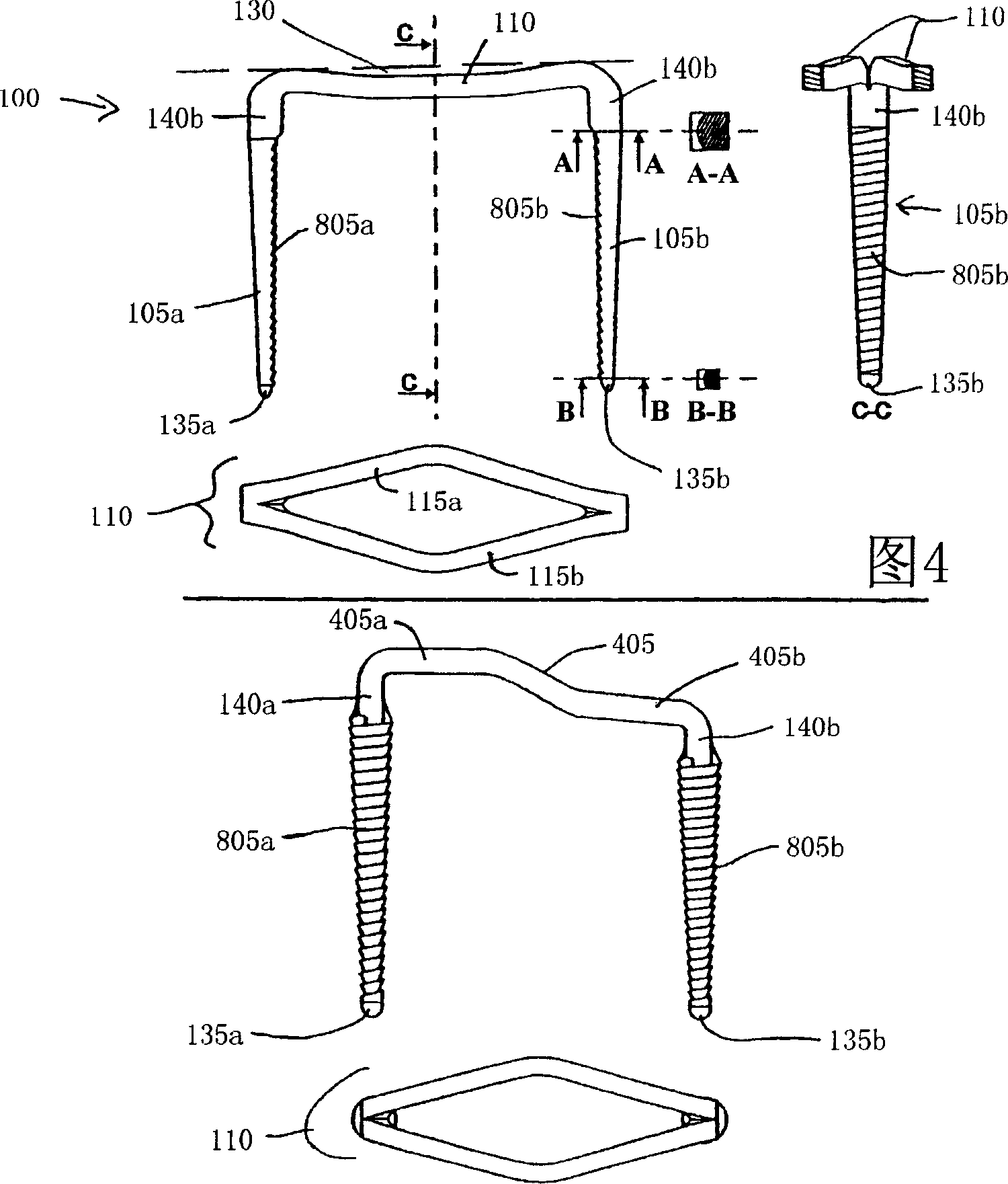 Osteosynthesis clip and insertion tool for inserting an osteosynthesis clip into bone tissue fragments