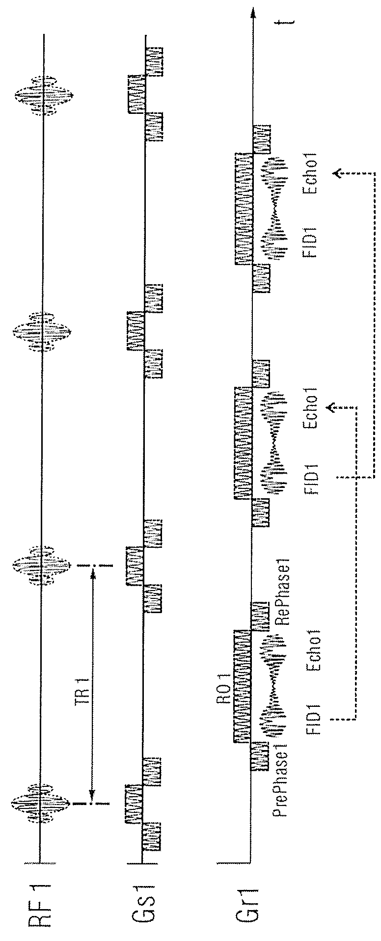 Magnetic resonance imaging method and apparatus