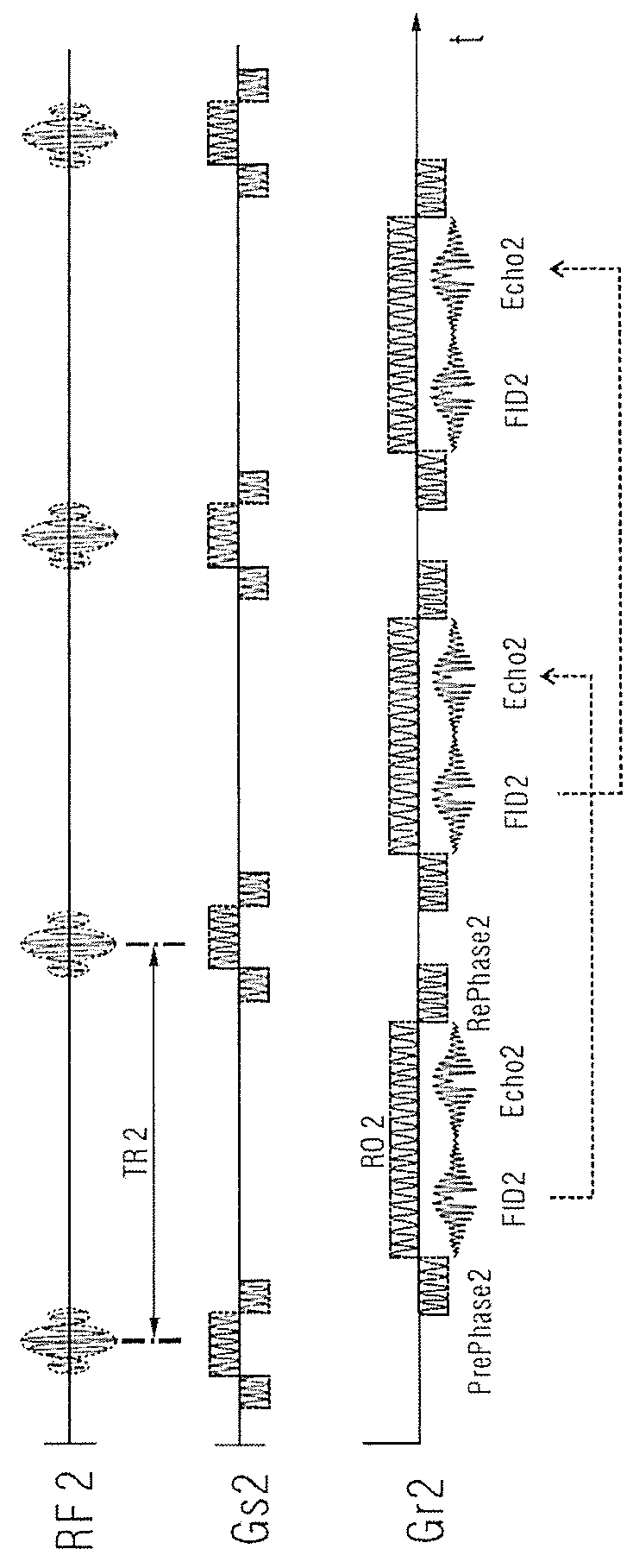 Magnetic resonance imaging method and apparatus