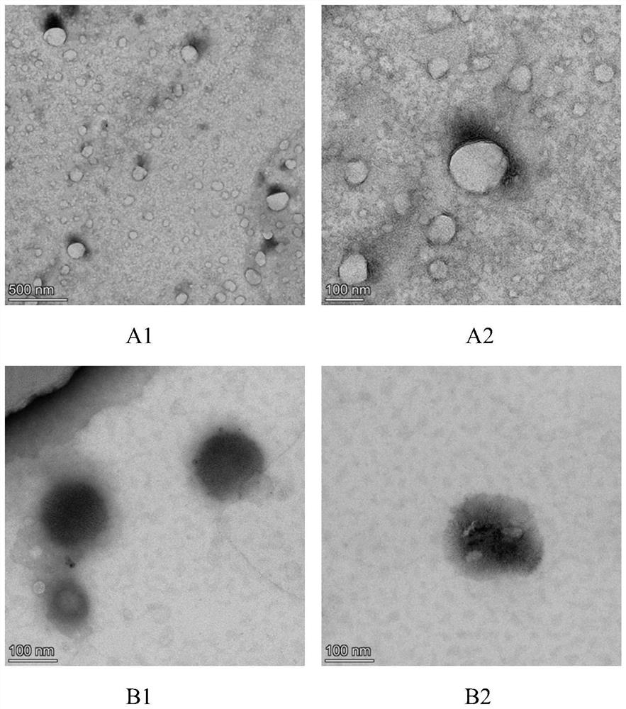 Chondroitin sulfate-chitosan multilayer modified betacyanin liposome and preparation method thereof