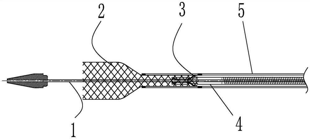 Intravascular stent releasing device