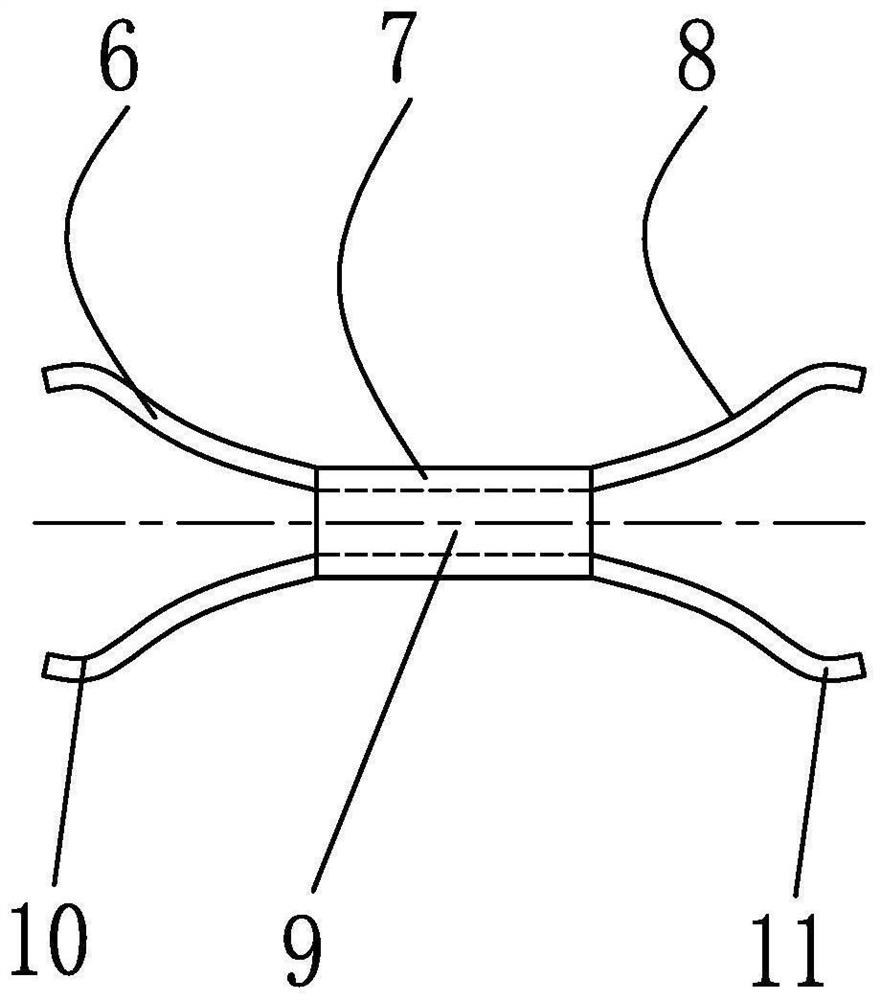 Intravascular stent releasing device