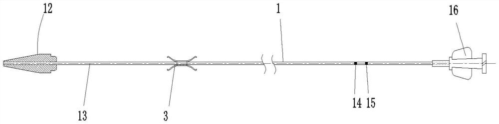 Intravascular stent releasing device