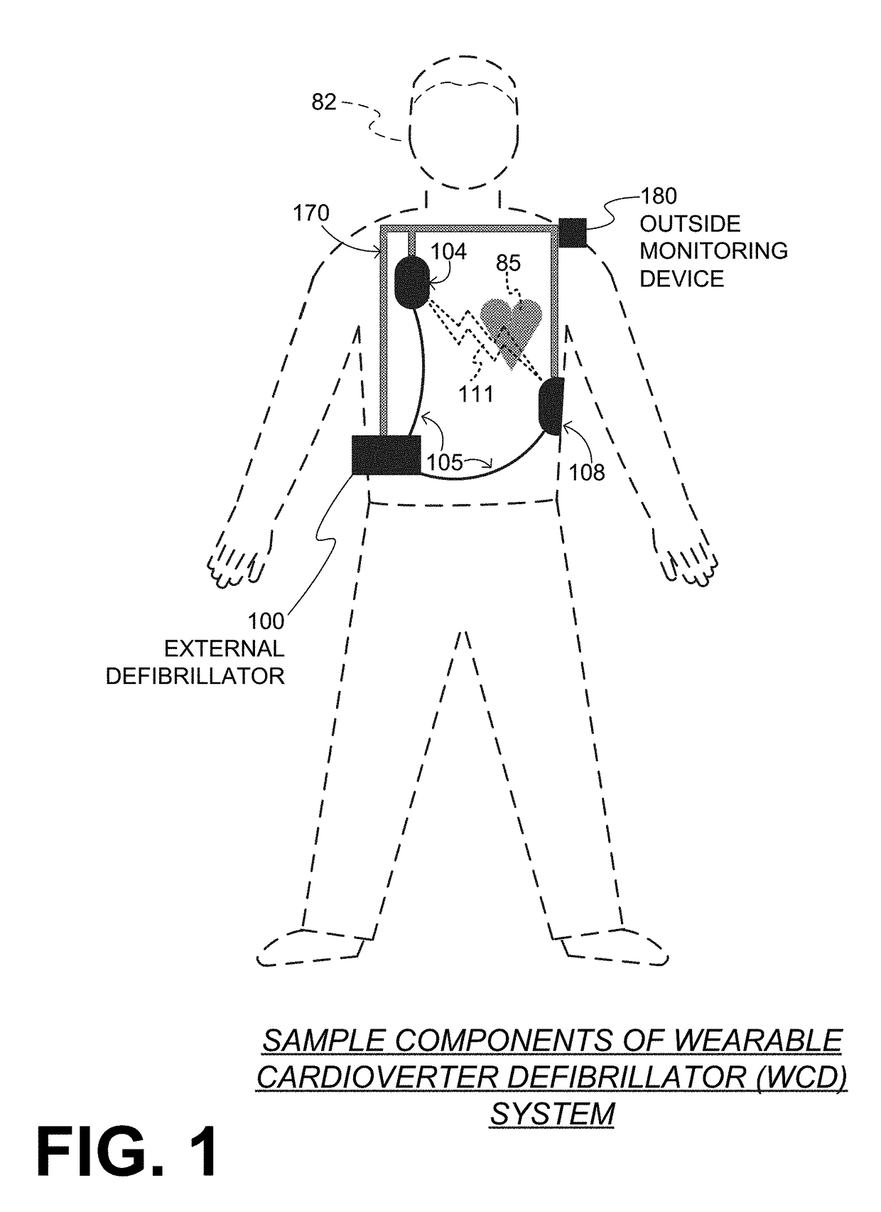 Wearable cardioverter defibrillator (WCD) causing patient's QRS width to be plotted against the heart rate