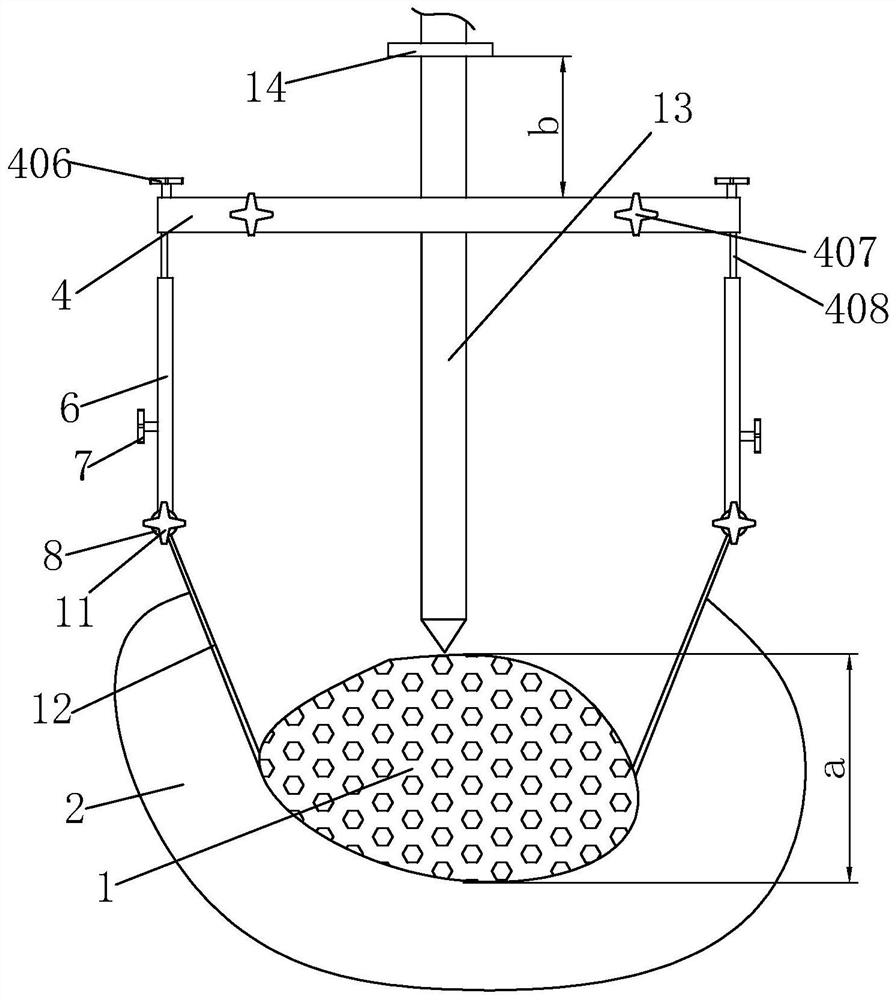 A minimally invasive embracing porous osteotomy device