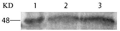 High-expression fermentation process of avian bursa virus VP2 protein