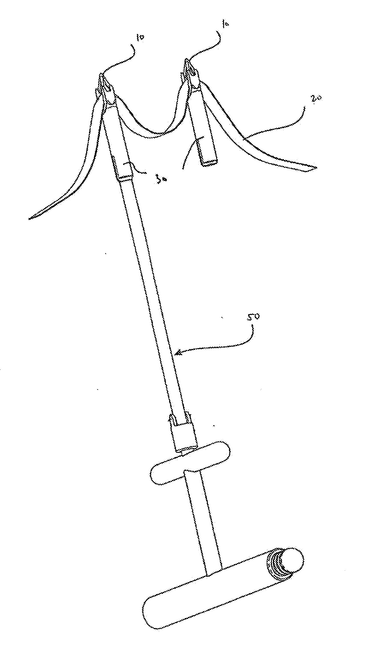 Method of Performing a Mastopexy Procedure