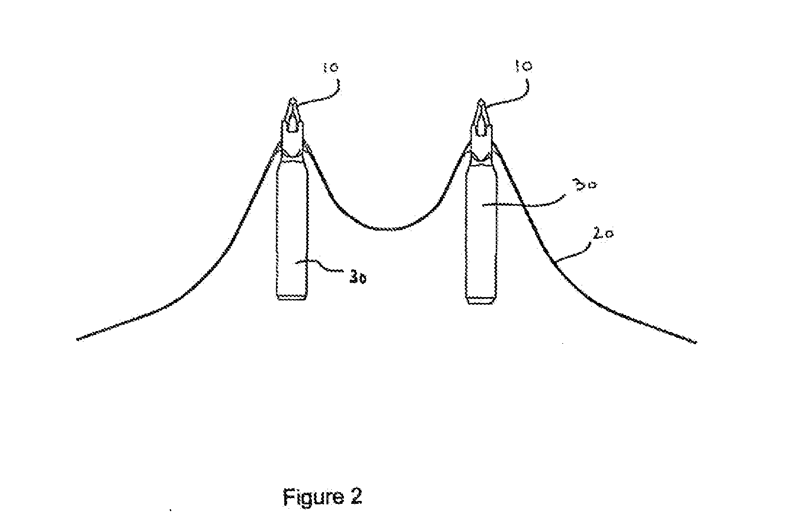 Method of Performing a Mastopexy Procedure