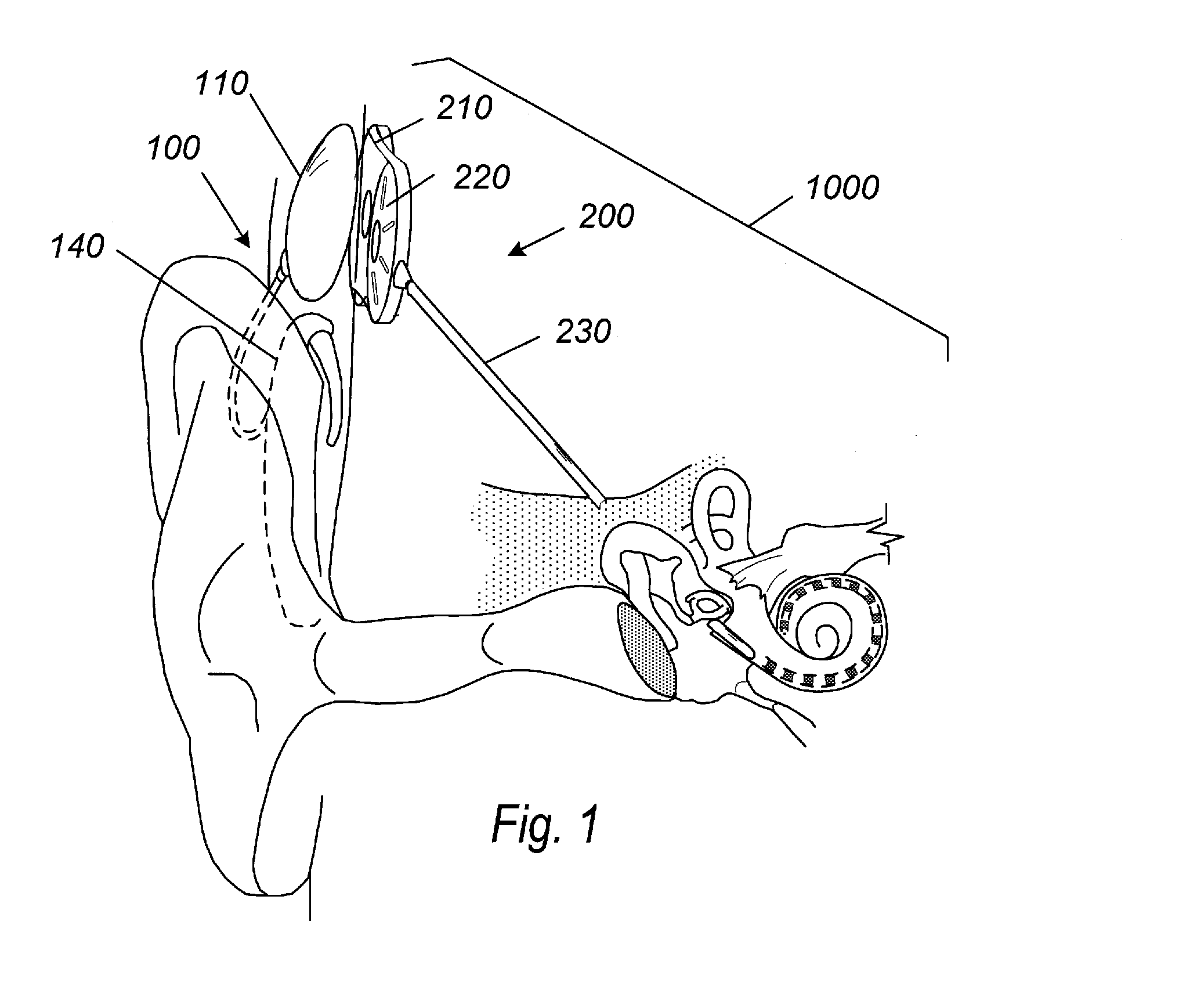 Waterproof acoustic element enclosures and apparatus including the same